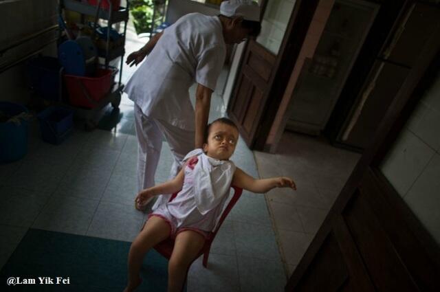 Foto Anak-Anak Korban Agent Orange Di Vietnam