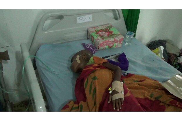 Derita Gizi Buruk, Kondisi Balita di Depok Memprihatinkan
