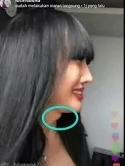 Operasi Jakun, bisa atau tidak ?