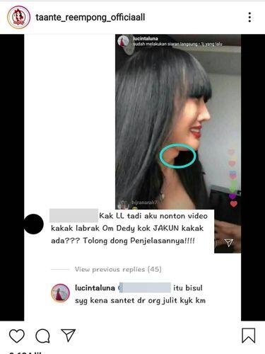 Nah Lho! Seperti Punya Jakun, Lucinta Luna Sebut Cuma Bisul