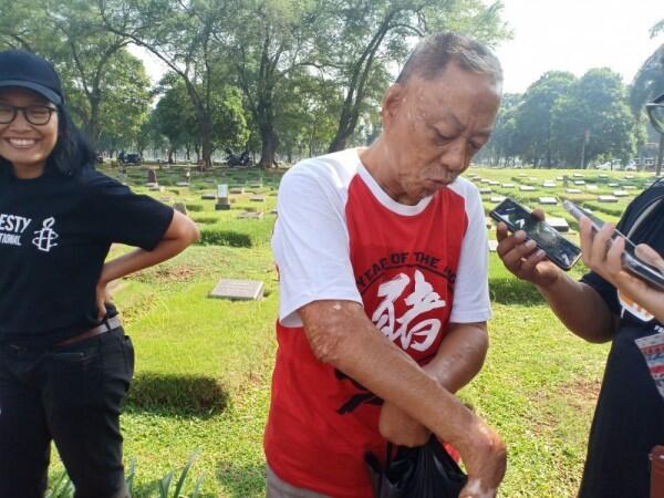 Kisah Pilu Iwan, Dibakar Hidup-hidup Saat Kerusuhan Mei 98