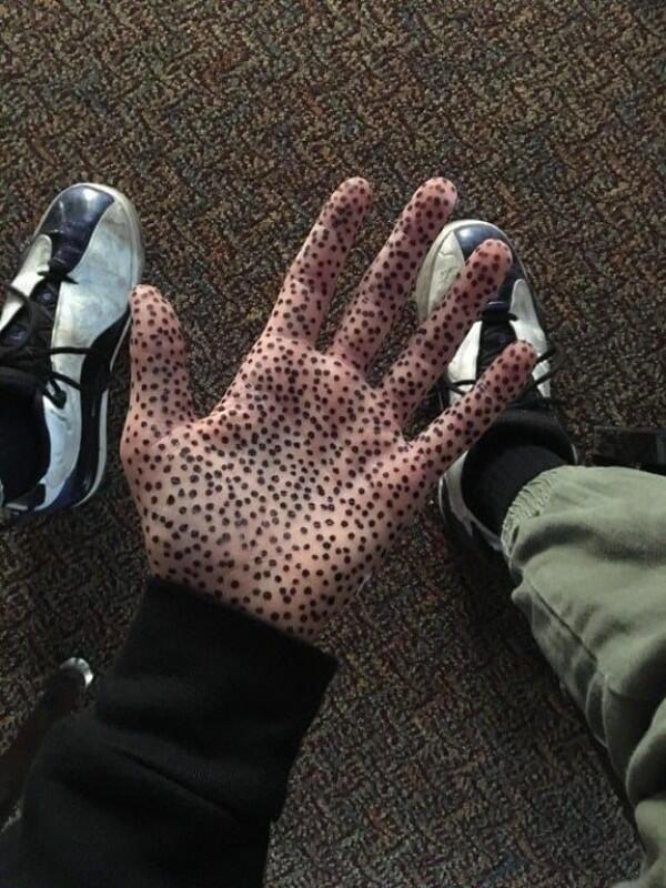 Tak Sengaja Trypophobia, 11 Benda Sederhana Ini Bikin Merinding Total