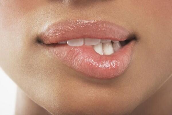 5 Tips Atasi Bibir Kering & Pecah-pecah Selama Puasa