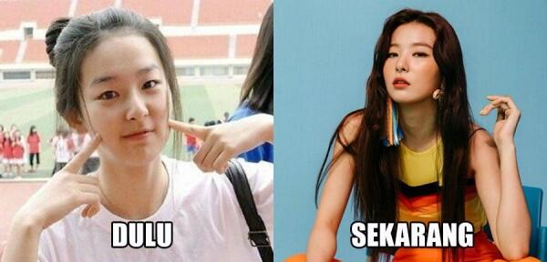 10 Bukti Kalau Idola KPop Paling Memesona Ini Pernah Alay