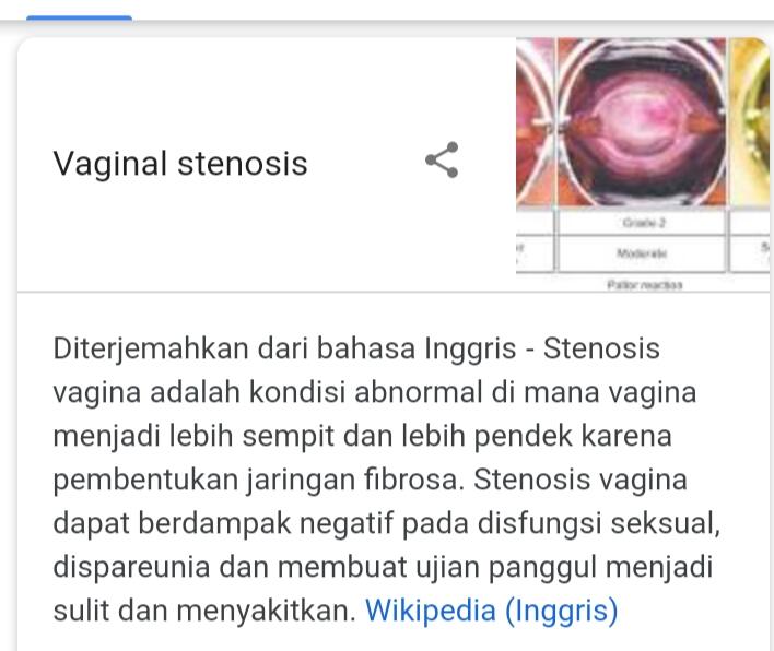 Stenosis Vagina. Operasi Yuks