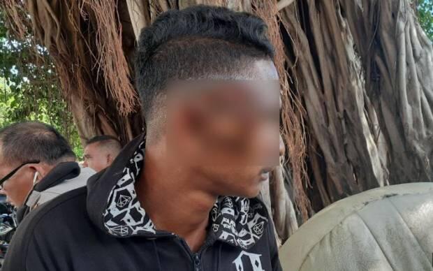 Oknum Polisi di Sikka NTT Tempelkan Wajah Pemuda Ini ke Knalpot Panas