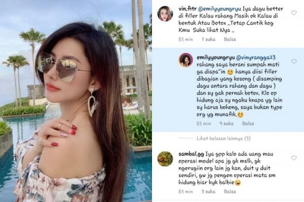 10 Fakta Emily Young, Jebolan Indonesian Idol yang Makin Mirip Barbie