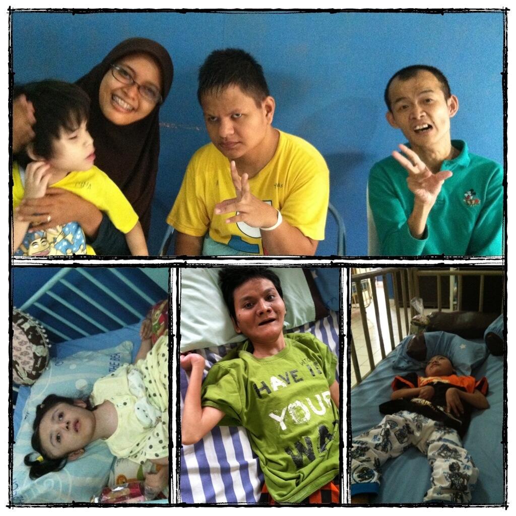 Macam / Jenis Cacat Pada Manusia (Disabilitas)