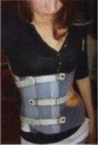 Aktris Cuuuantik Shailene Woodley dgn Scoliosis (Tulang Bengkok) Semangat &amp; Bersyukur