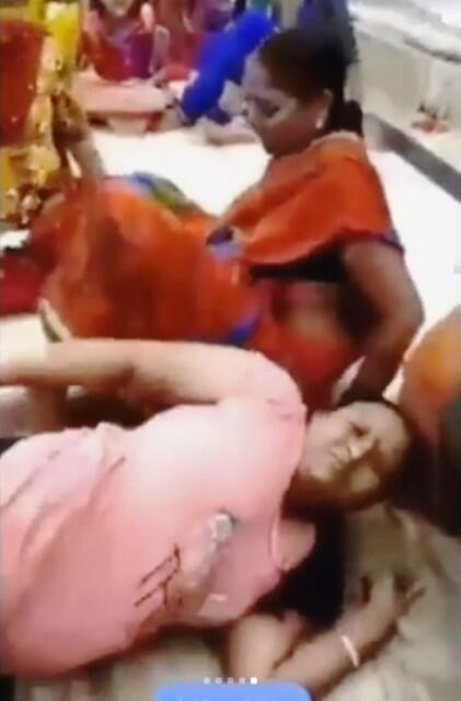 Viral Demi Konten Instagram, Perut Wanita Asal India Ini Sampai Terjepit di Patung