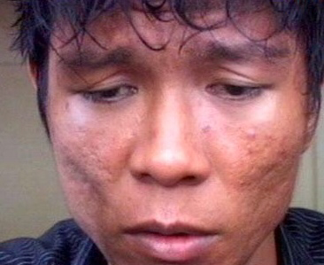 Cara Mengatasi Sakit Hati Cewe (penting bagi para cewe)