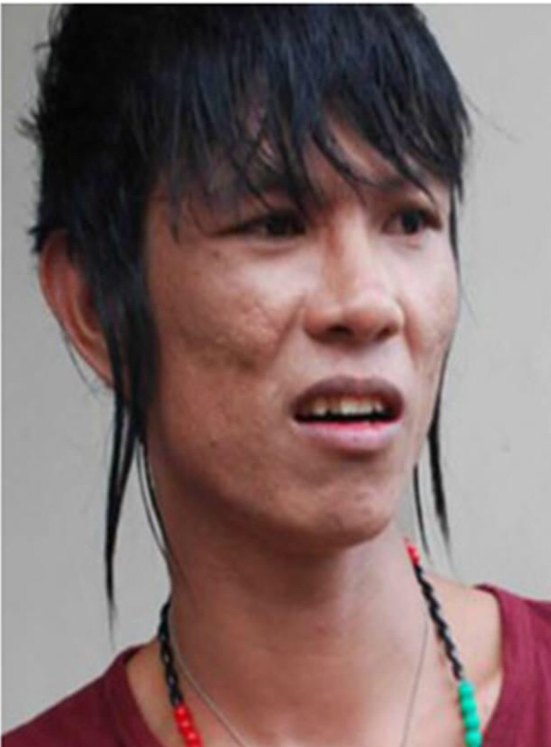 Cara Mengatasi Sakit Hati Cewe (penting bagi para cewe)