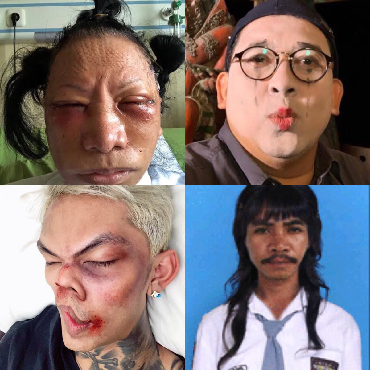 Cara Mengatasi Sakit Hati Cewe (penting bagi para cewe)