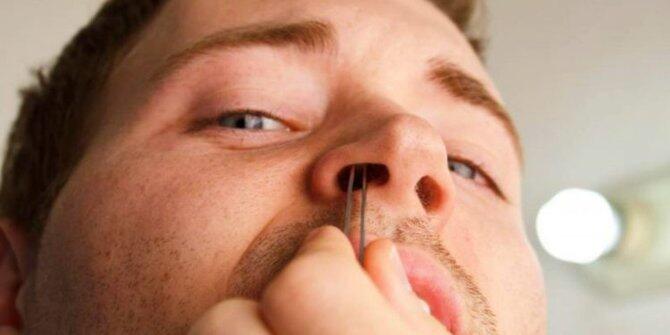 Sejumlah Bahaya yang Bisa Muncul dari Kebiasaan Mencabuti Bulu Hidung