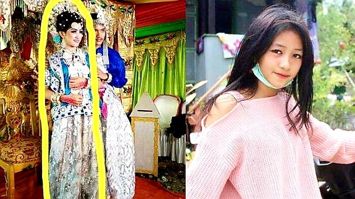 Istri Tewas Akibat Ciuman Brutal 😱 Suami di Malam Pertama, Titik Berbahaya di Leher