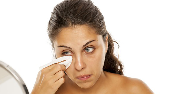 Bukannya Bersih, Face Wipes Malah Bikin Jerawatan?!