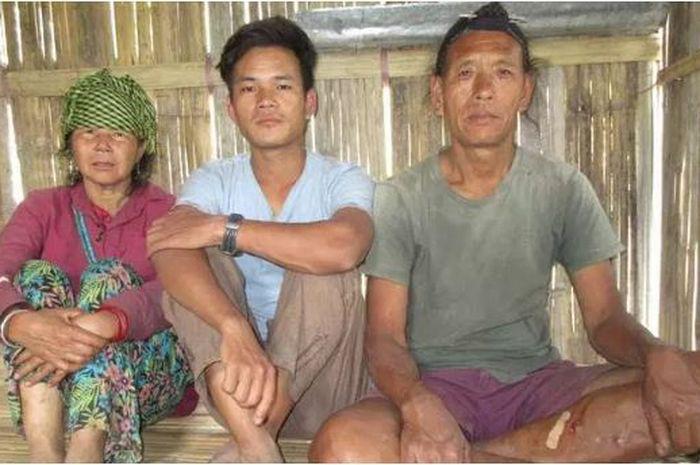 Mengenal Anang Tadar Si Miskin Penemu Kaca Mata G4B, UNICEF Kagum!