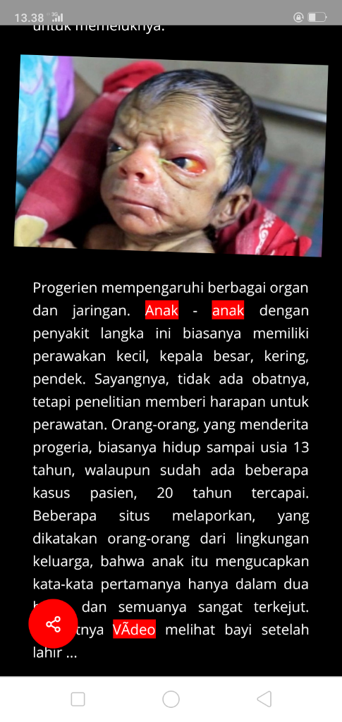 Bayi Ini Lahir Dengan Wajah Tidak Biasa, Haruskan Menjadi Sebuah Beban Kehidupan?