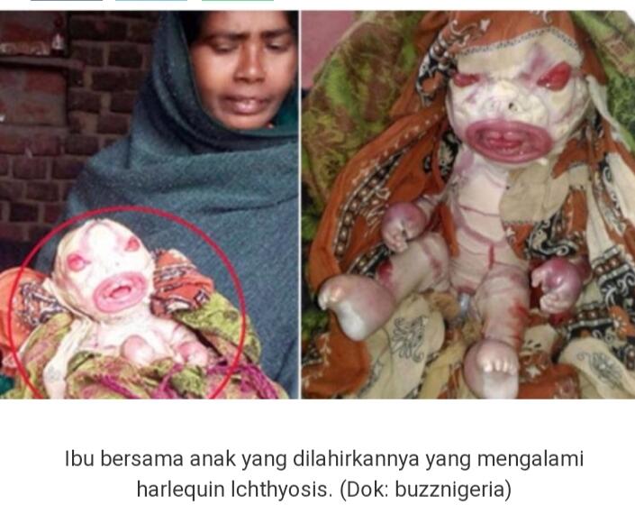 Bayi Alien! Apakah Anda Selingkuh?