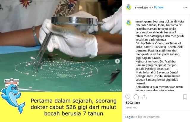 Kelainan Gen! Bocah Ini Memiliki 526 Gigi Yang Bersembunyi Dalam Rahang Bawah