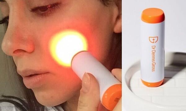 5 Rekomendasi Produk untuk Atasi Jerawat Membandel, Bye Acne Spot!