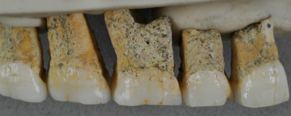 Spesies Manusia Purba Baru, 9 Fakta Menarik Homo Iuzonensis