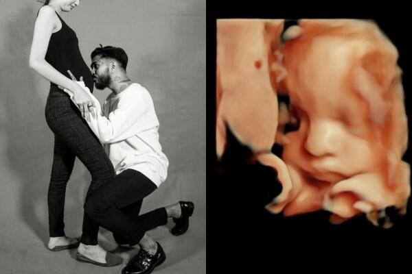 Bakal Punya Anak, 10 Potret Mesra Onadio Eks Killing Me Inside & Istri