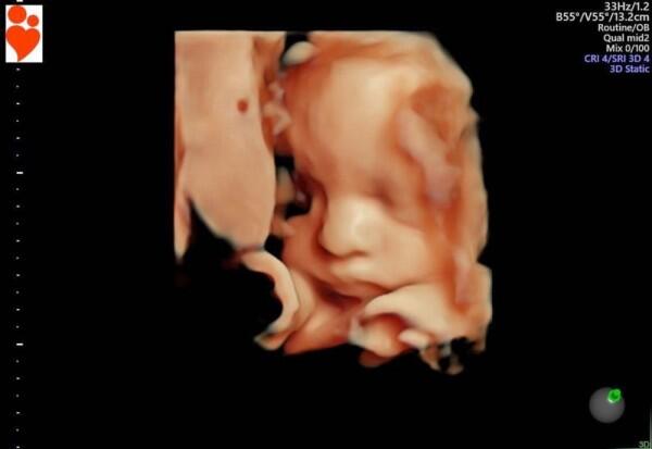 Bakal Punya Anak, 10 Potret Mesra Onadio Eks Killing Me Inside & Istri
