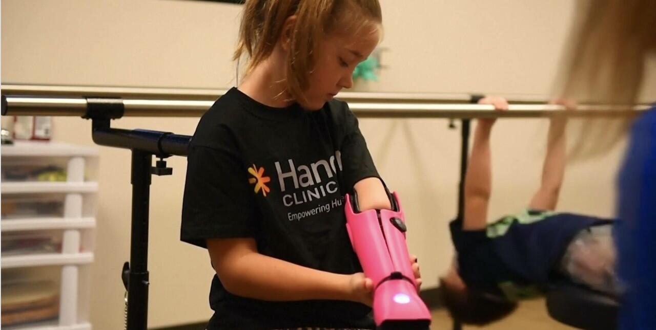 Perkenalkan Hero Arm, Tangan Robot Penuh Warna Untuk Disabilitas