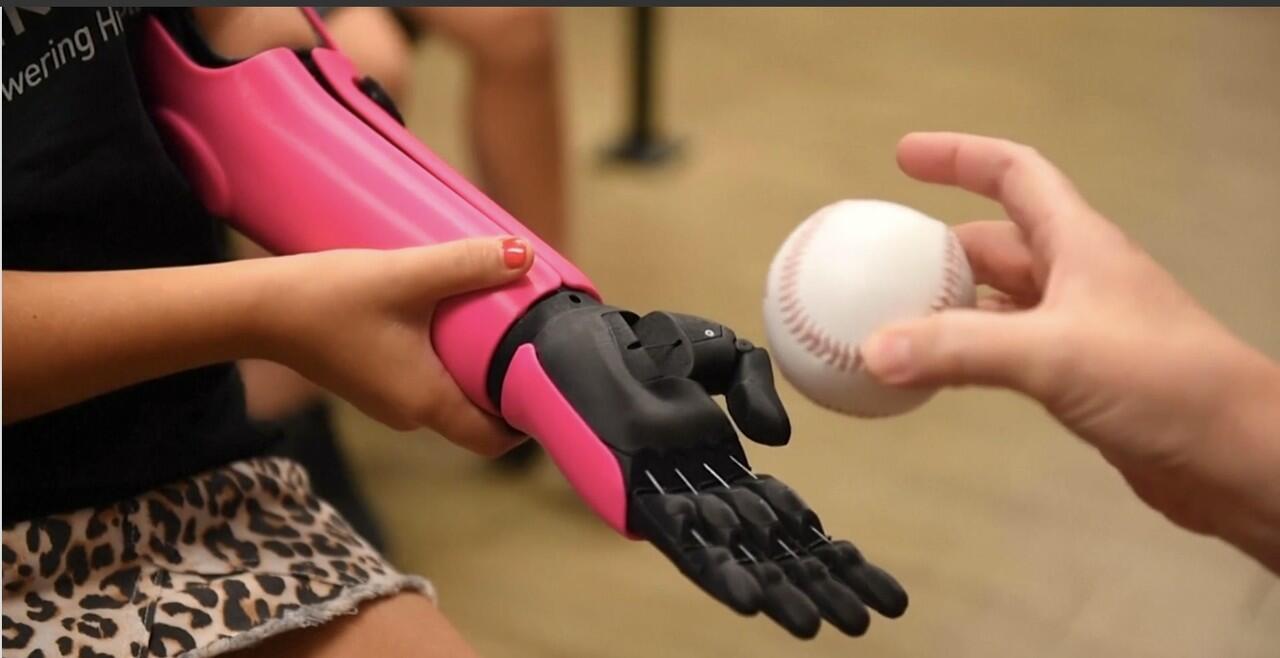 Perkenalkan Hero Arm, Tangan Robot Penuh Warna Untuk Disabilitas