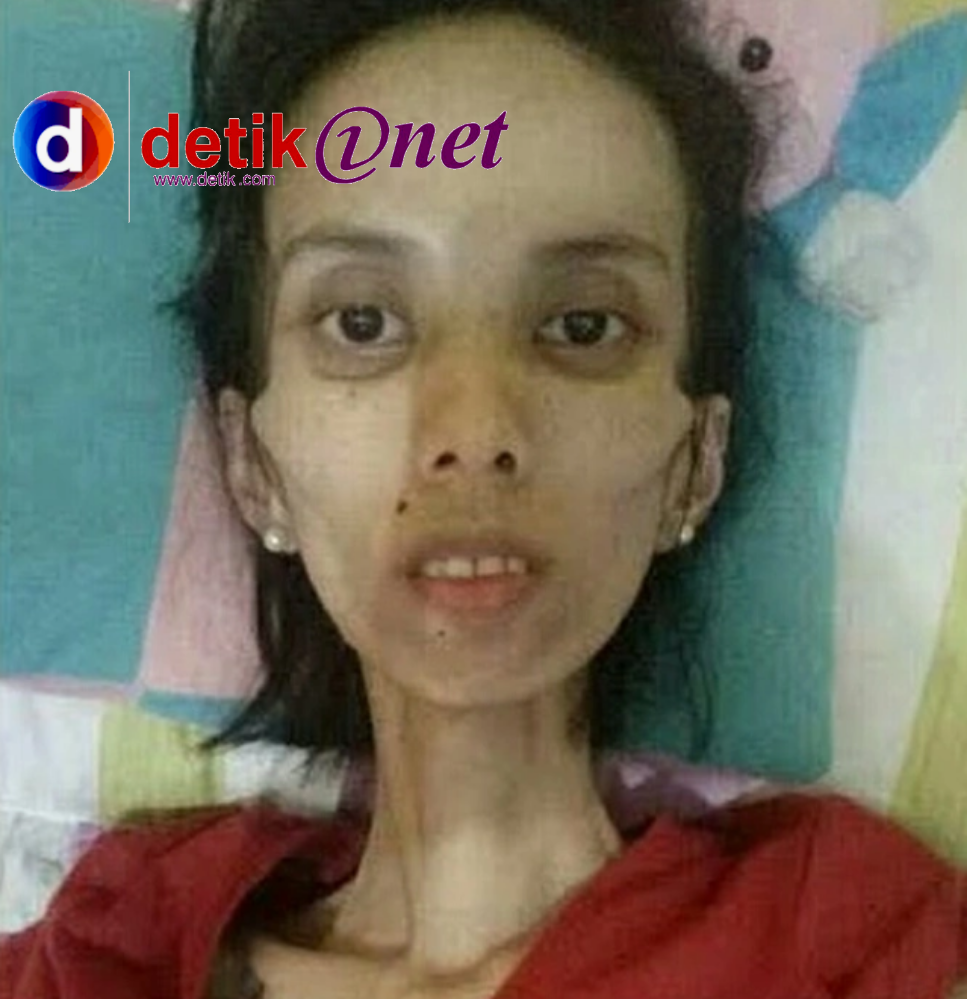 BERBAGI PENGALAMAM SAKIT KANGKER SERVIK