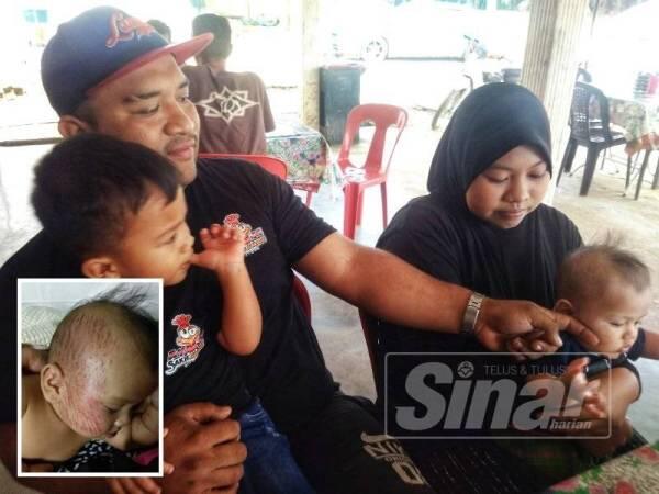 TRAGIS! Ibu dan Anak Tertimpa Durian Runtuh. Bukan Untung tapi malah Sial
