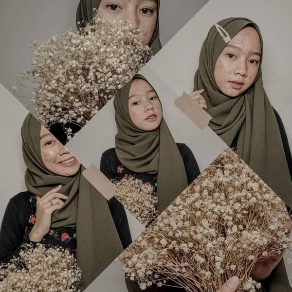 Tips Percaya Diri ala Novia Nur Ismi Selebgram 'Acne Fighter'