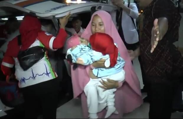 Tim Dokter RSUD dr Soetomo Berhasil Pisahkan Bayi Kembar Siam asal Kendari