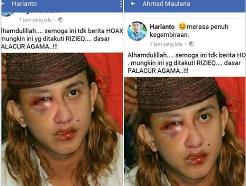 Benarkah Habib Bahar bin Smith Dipukuli di Lapas Cibinong?