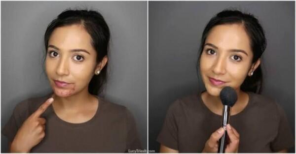 Ingat 5 Tips Penting Ini Sebelum Menutupi Jerawat dengan Makeup