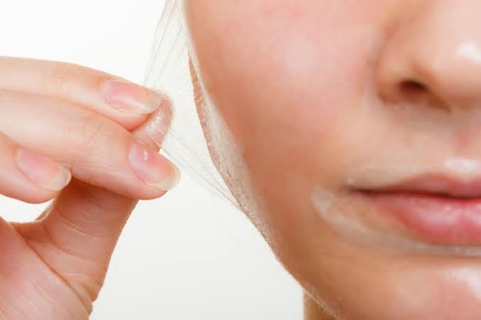 Ketika sedang berjerawat, boleh Agan/Sista memakai masker peel off?