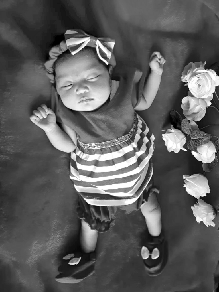 Rontgen, Penting Bagi Bayi? Kalau Saja Dilakukan Mungkin Dia Masih Disini