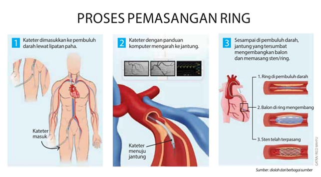 Mengenal Perkembangan Teknologi di Bidang Kesehatan Indonesia Selama 6 bulan Terakhir