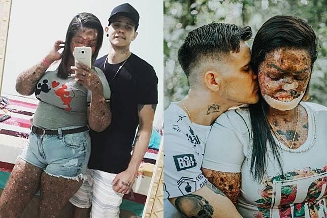 Viral Pria Menikahi Pacarnya yang Buruk Rupa! Benarkah Cinta Sejati Itu Ada?