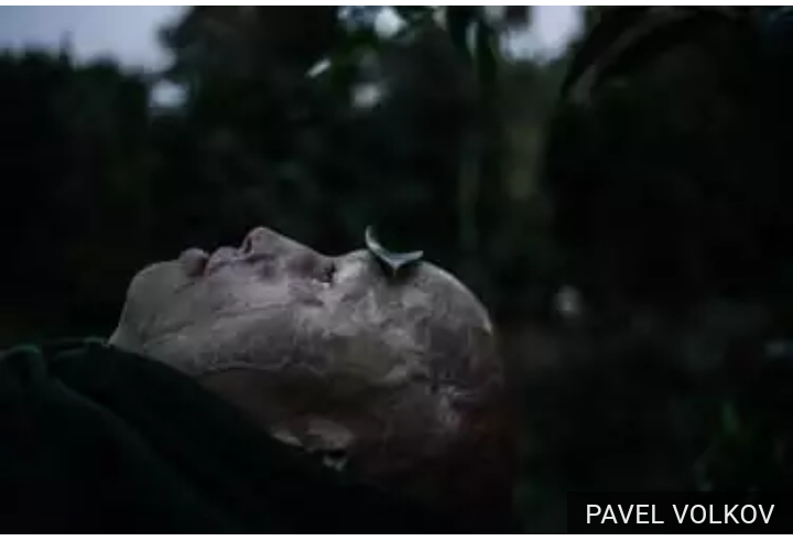 Cerita luar biasa Lyosha, dilempar sang ayah ke bara api saat berusia dua tahun