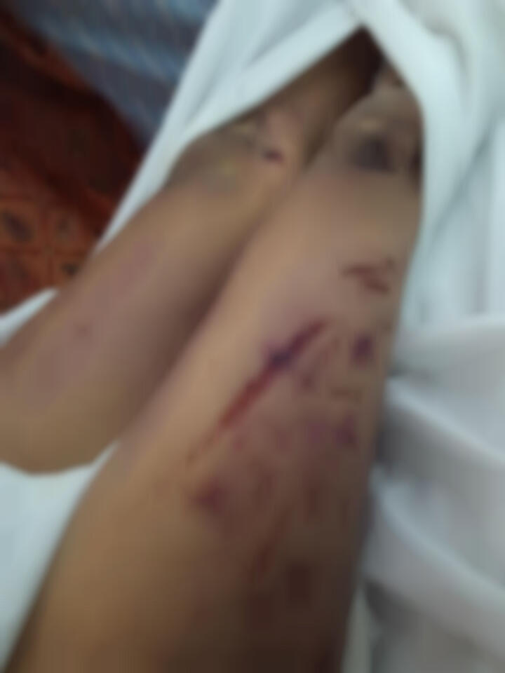 Mayatnya Penuh Lebam, Mahasiswa Unila Meninggal di Diksar Mapala