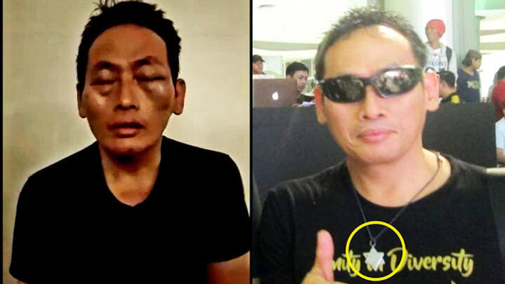 Ini Peran 11 Tersangka Penganiaya Ninoy Karundeng Relawan Jokowi