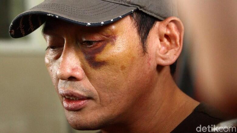 Ninoy Sebut Habib Ingin Buang Mayatnya di Kerusuhan