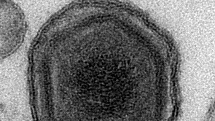 GAWAT! Virus Demam Babi Afrika Ancam NTT, Menyebar dari Timor Leste, Kenali Gejalanya