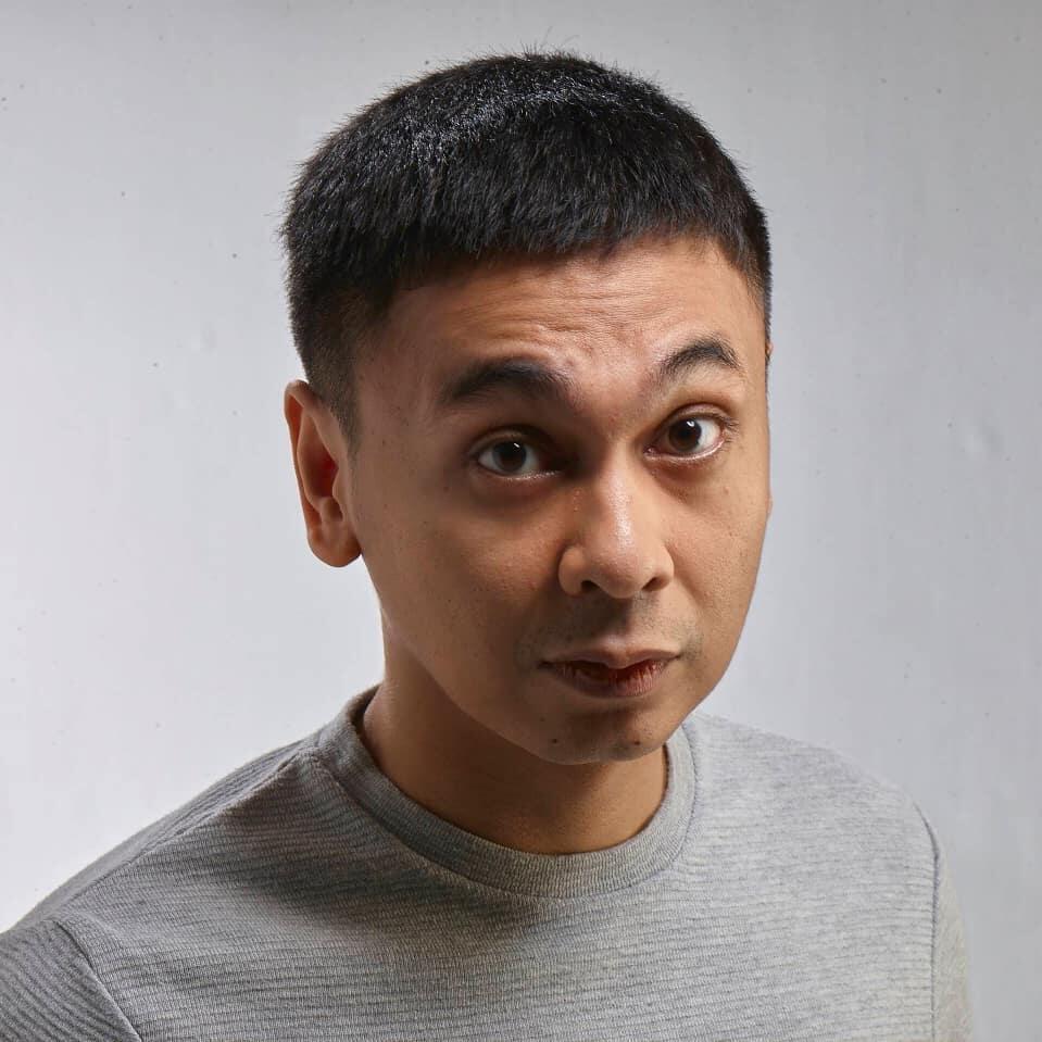 Deretan Artis Ini Mengidap Autoimun