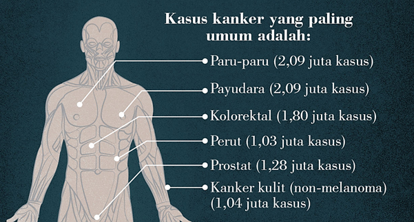Indonesia Merupakan negara dengan Paparan surya yang tinggi, awas Kanker Kulit