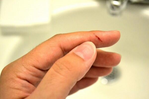 Kenapa Paper Cut Terasa Sangat Sakit? Ini Penjelasannya Menurut Sains!