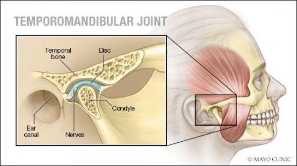 Kenali 7 Penyebab Sakit di Bagian Pelipis, dari Migrain hingga Tumor