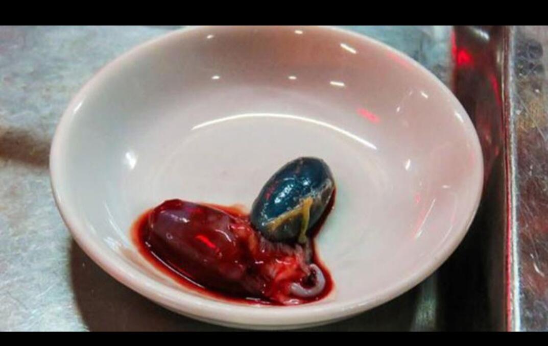 Ada Yang Mau Coba Makanan Ini?